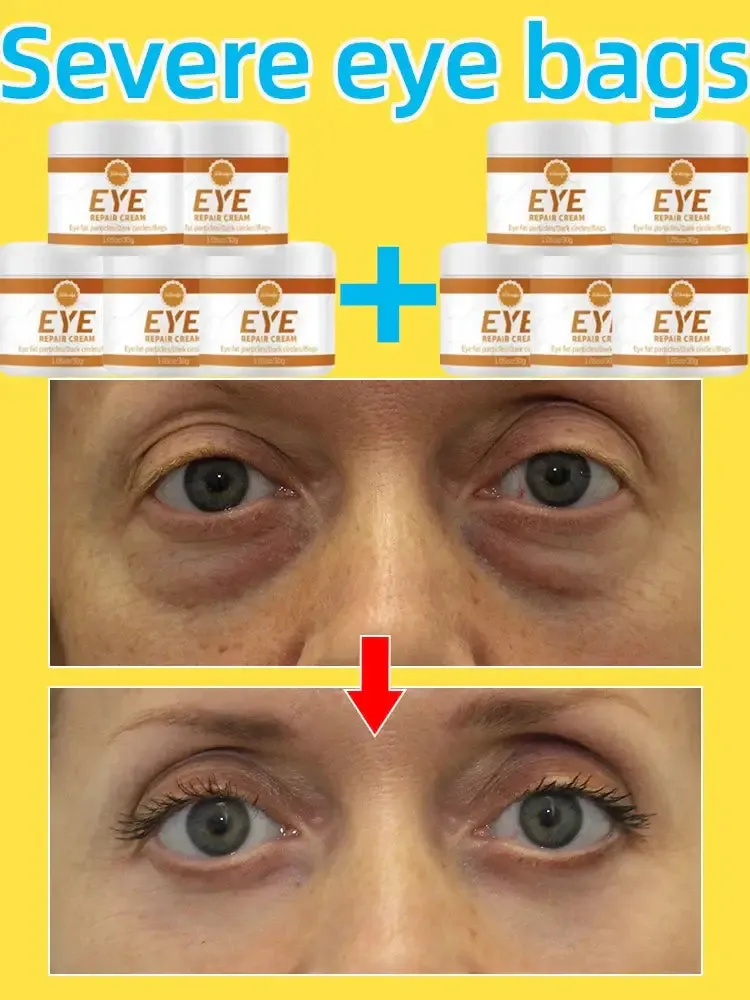 Eye Repair Cream