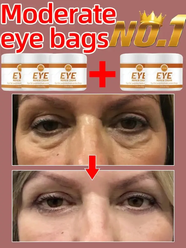 Eye Repair Cream