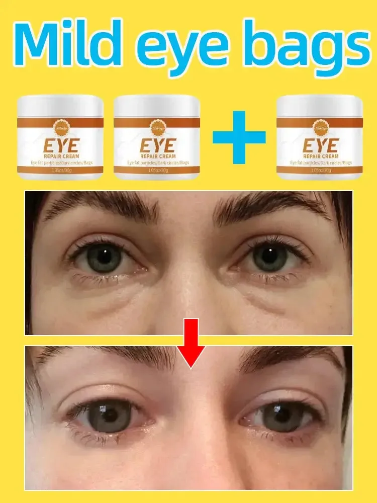 Eye Repair Cream
